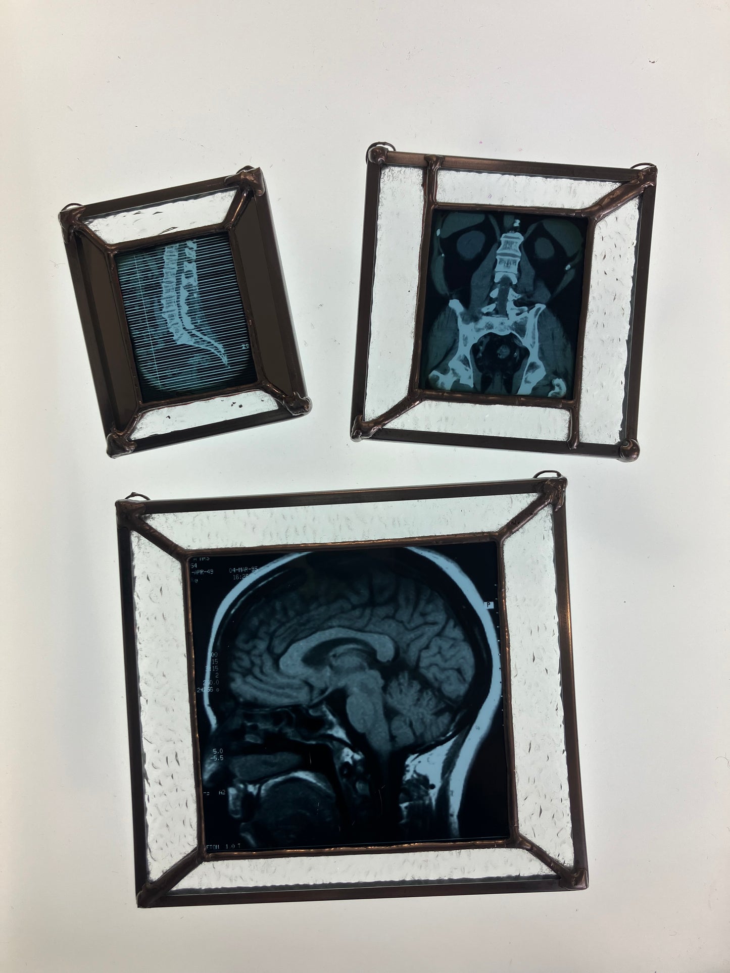 SOLD - Brain Scan Sagittal Plane View