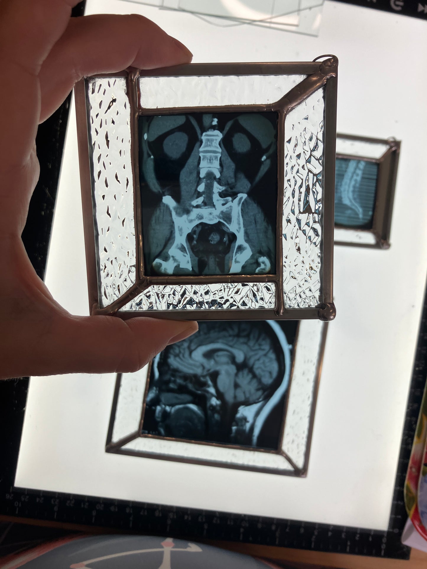 SOLD - A torso cross section sun catcher - Pelvis, Spine and Kidney