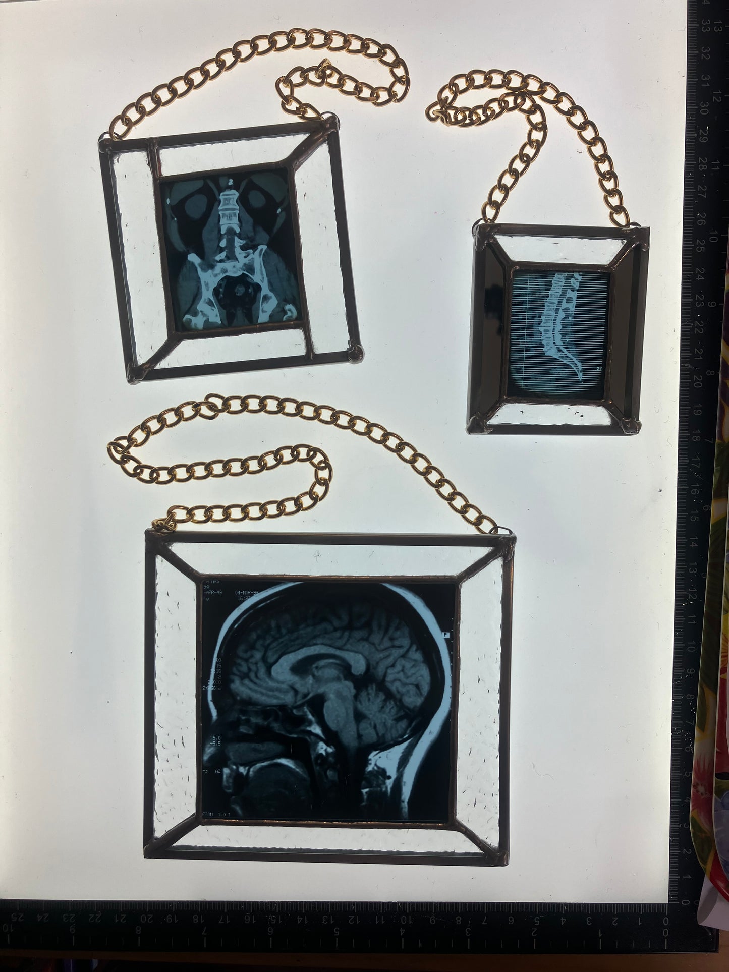 SOLD - Brain Scan Sagittal Plane View