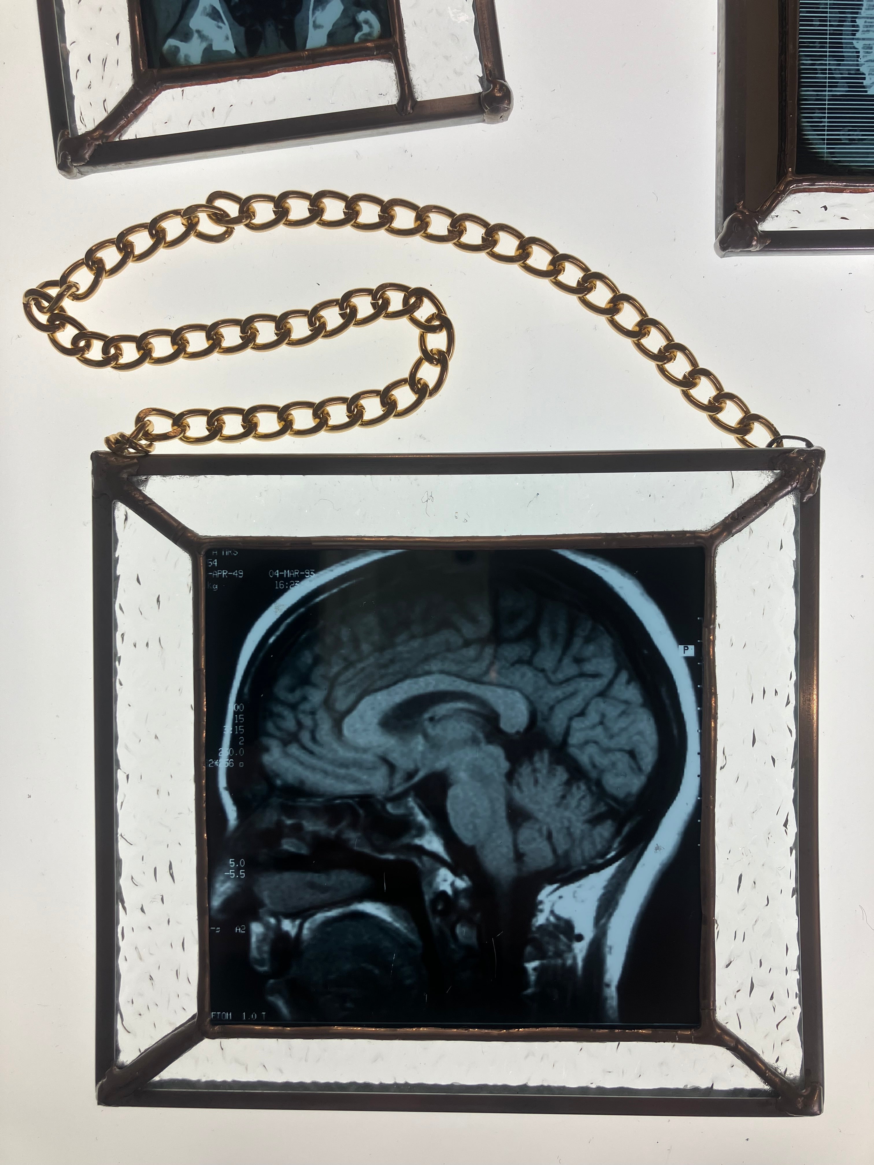 SOLD - Brain Scan Sagittal Plane View β TheBorderlineGlass