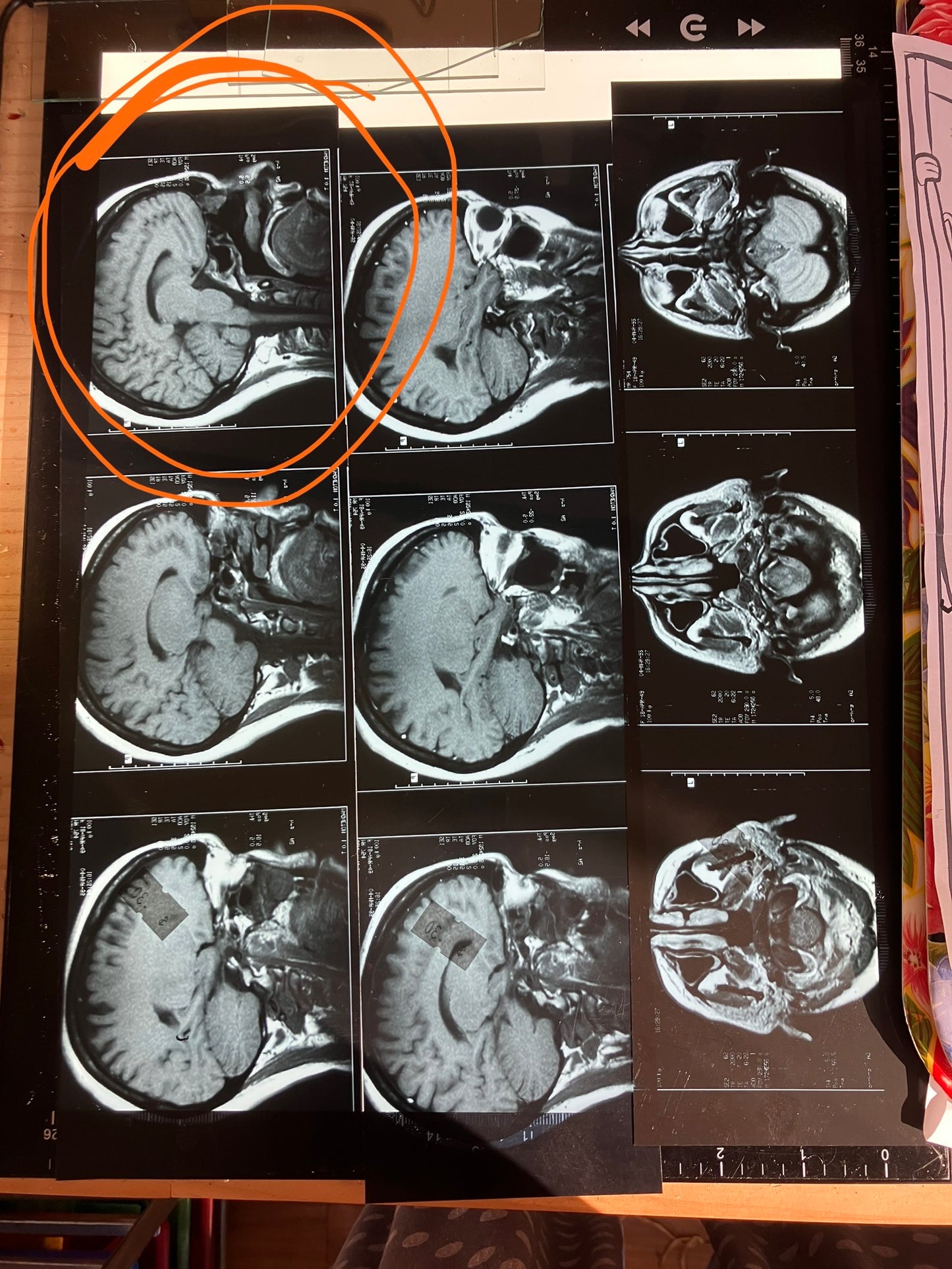 Reserved for NeonEel