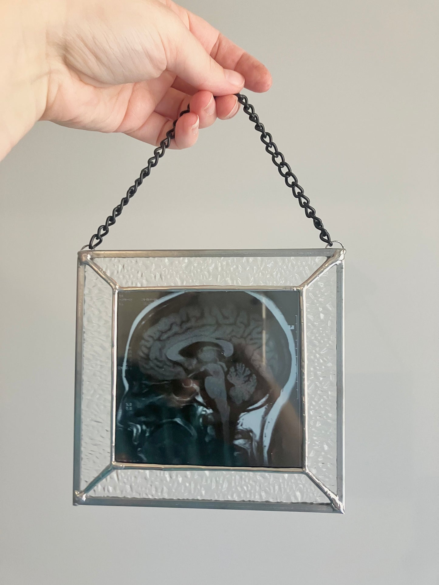 SOLD - Brain Scan Sagittal Plane View