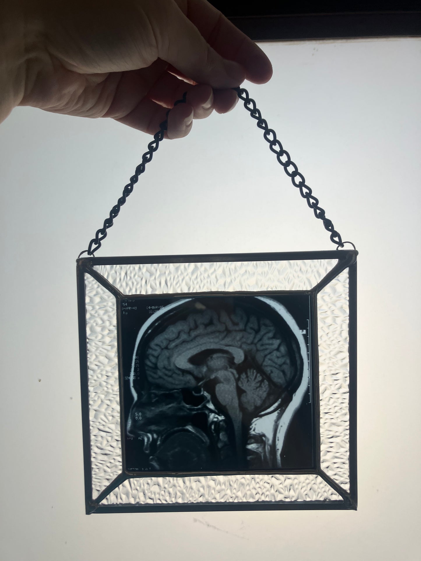 SOLD - Brain Scan Sagittal Plane View