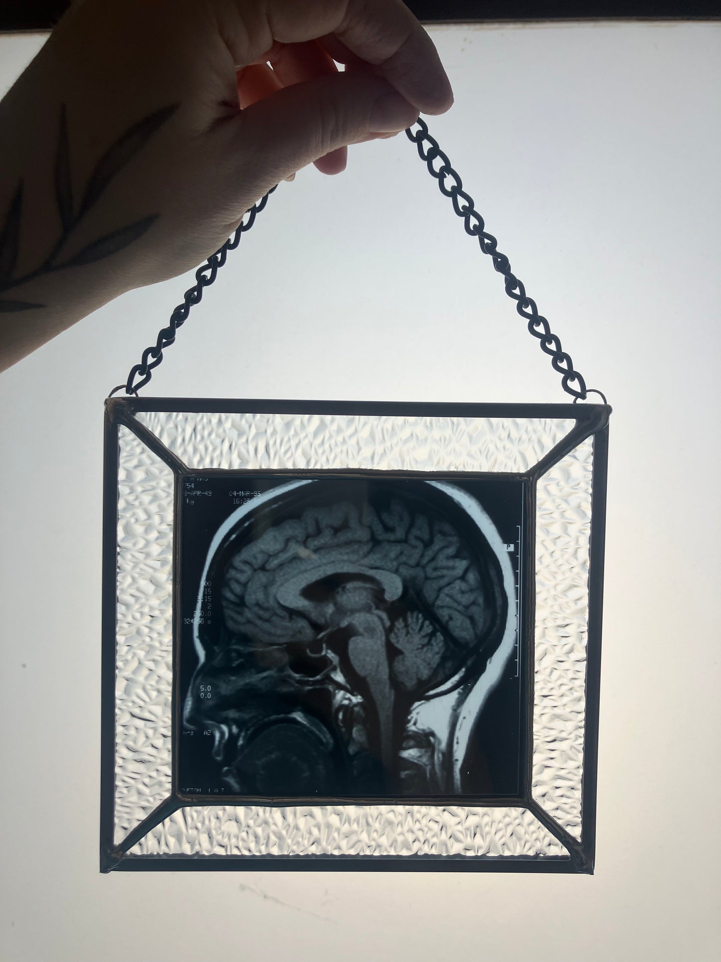 SOLD - Brain Scan Sagittal Plane View