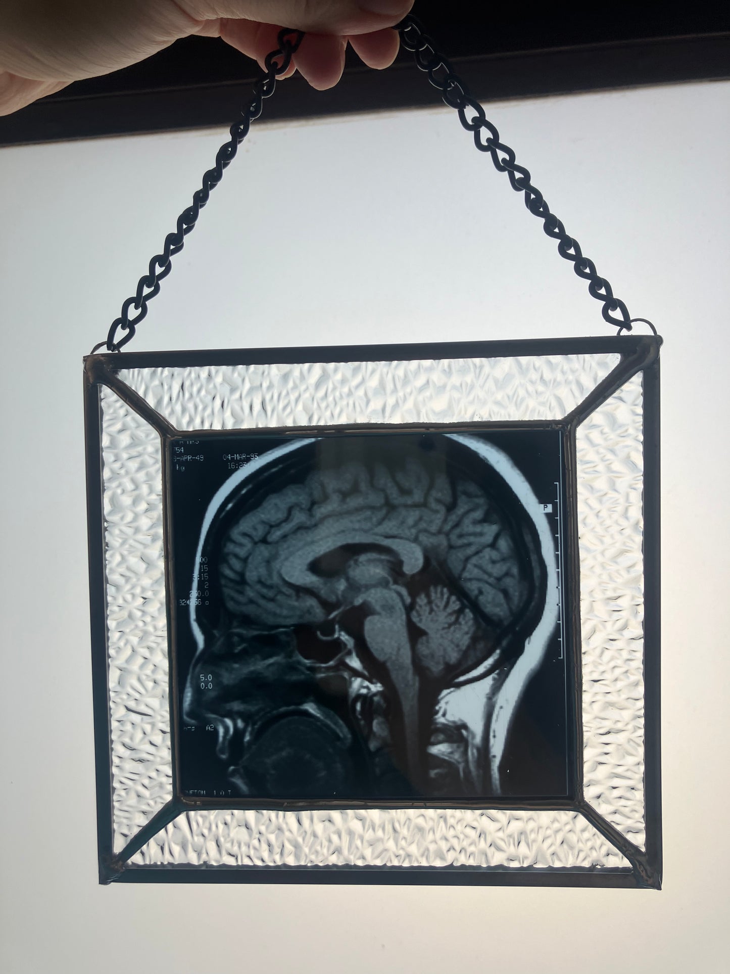 SOLD - Brain Scan Sagittal Plane View